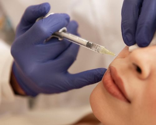 Dermatología Estética en Redován | dePiel Clínica Dermatológica